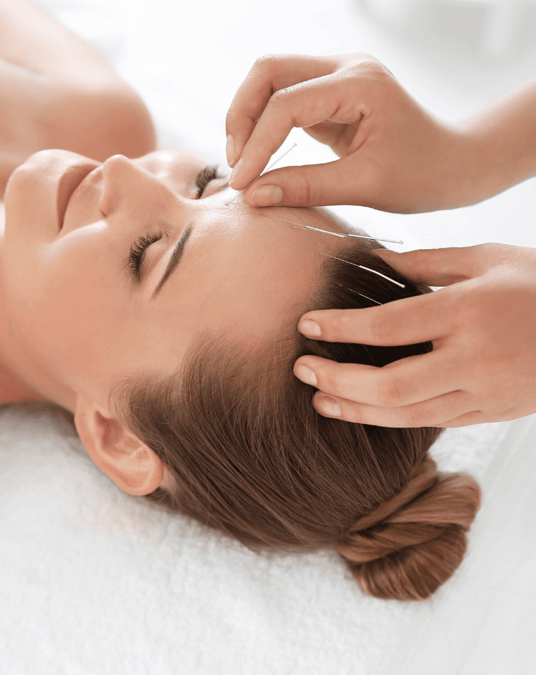 The Healing Benefits of Acupuncture
