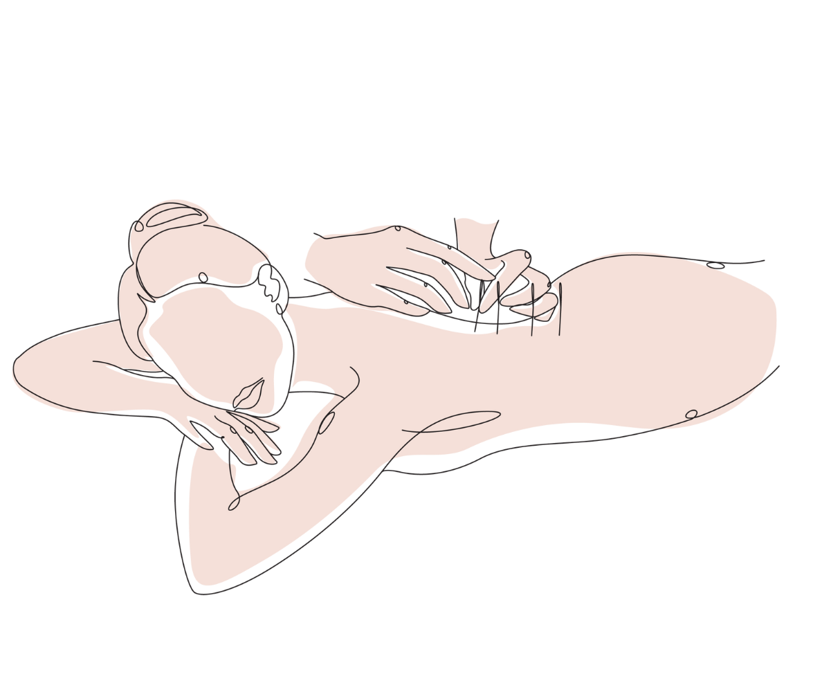 Acupuncture for Pregnant Women